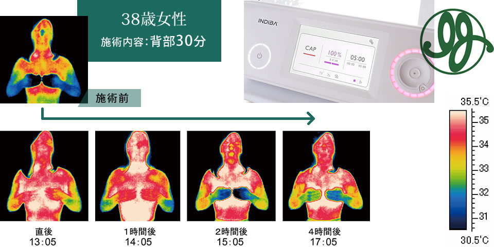 フェイシャルエステルーム